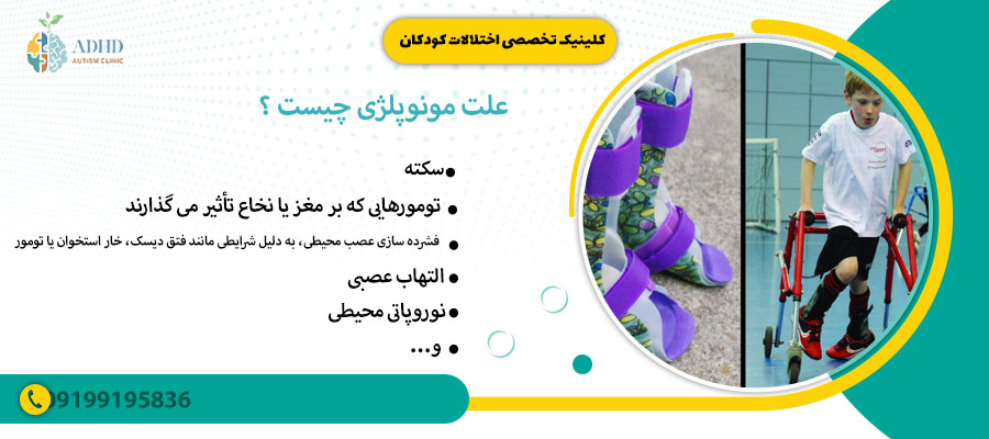 علت مونوپلژی چیست ؟